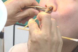 头痛、鼻塞恐不只是感冒