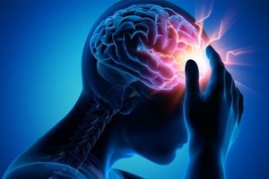 谁是脑中风高危险群和如何预防？