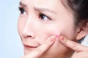 「挤痘痘」可真是个技术活儿