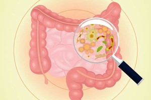 （示意图：互联网）