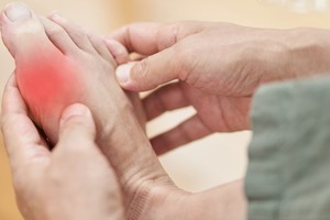 大鱼大肉不断 当心“痛风”找上门！