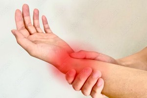 刷手机腕根有压痛，拇指一动哢哒响是腱鞘炎？