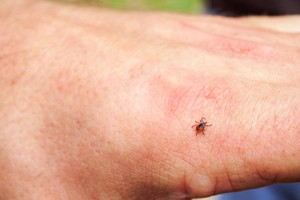 日本首次确认出现“蜱虫病”人际间传播。（图：新京报）