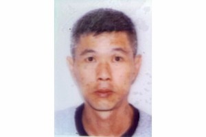 贫困青年患上严重肺病