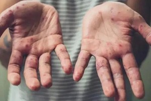 （示意图：互联网）