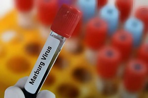 （示意图：互联网）