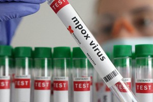 加拿大卫生部门当地时间22日确认，该国出现首例猴痘病毒新变异毒株“分支Ib”感染病例。（示意图：互联网）