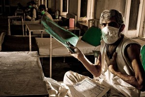 全球多年来在抗击结核病方面取得的进展。（示意图：WHO）