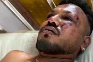 在这场坠机事故中，出现一名奇迹生还者。（图：互联网）