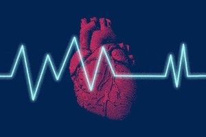 熬夜到什么程度会猝死？