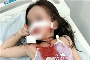 4岁女童在广场遭狗袭击 致面部严重受伤