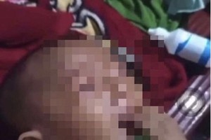 一名女婴遭父亲用双氧水滴入阴部导致剧烈哭喊的画面。图：社交网。