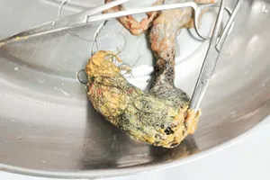 Phẫu thuật lấy búi tóc dài 12cm trong ruột bé gái 4 tuổi