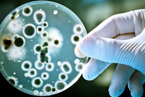 霍乱弧菌极易传播。