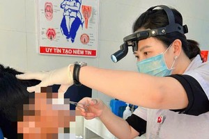 广治省向化区域全科医院成功为一名鼻腔内有异物的患者实施内窥镜取出手术。