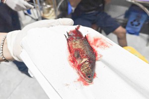 罕见！男子拉网捕鱼时，活攀鲈钻入喉咙卡在食道