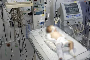 Bé sơ sinh 2 tháng tuổi nghi bị bạo hành nhập viện trong tình trạng nguy kịch