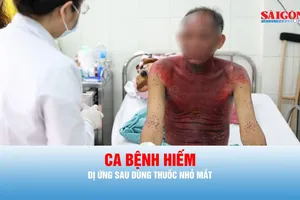 Podcast tin thời sự ngày 14-8: Thuốc nhỏ mắt có thể gây phản ứng dị ứng toàn thân