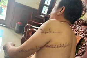 Truy tố 4 bị can vụ truy sát ông Nguyễn Khắc Tuấn