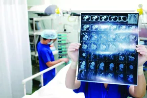 Vitamin B1 giúp phục hồi não