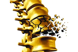 Ô nhiễm không khí làm tăng nguy cơ loãng xương 