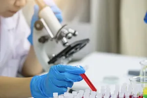  Công nghệ chỉnh sửa gene CRISPR tiên tiến  mở ra hy vọng điều trị bệnh bạch cầu