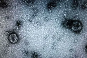  Việt Nam nuôi cấy, phân lập thành công nCoV, có thể xét nghiệm hàng nghìn bệnh phẩm mỗi ngày