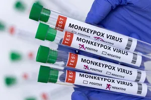 Việt Nam ráo riết chuẩn bị vaccine, thuốc điều trị đậu mùa khỉ