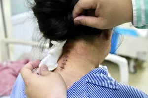 Nữ bệnh nhân 2 lần bị ung thư được phẫu thuật thành công