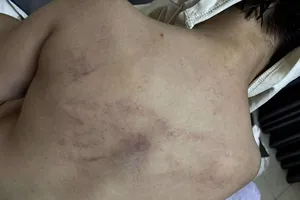 Đình chỉ 2 giáo viên nghi có hành vi bạo hành trẻ mầm non 