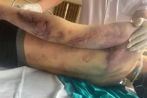 Rà soát toàn quốc cơ sở trợ giúp xã hội sau vụ học viên bị đánh tử vong