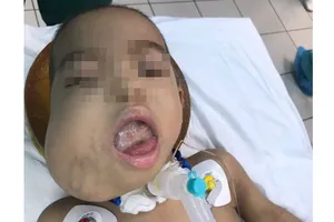 Bệnh nhân Ng. trước khi phẫu thuật