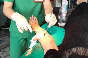 Cụ bà bị 30 vết thương do chó berger cắn phải nhập viện