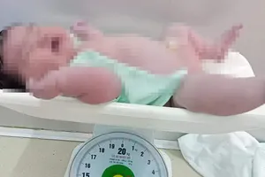 Bé sơ sinh nặng 6,2kg