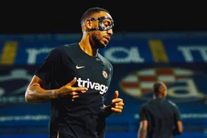 Pierre-Emerick Aubameyang phải thi đấu với mặt nạ bảo vệ xương hàm.