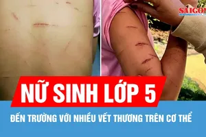 Cà Mau: Phát hiện học sinh lớp 5 đến trường với nhiều vết thương trên cơ thể