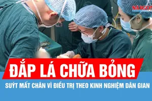 Suýt mất chân vì tự đắp lá chữa bỏng