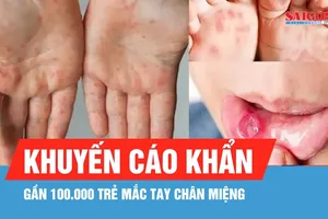 Gần 100.000 trẻ mắc tay chân miệng, Cục Phòng bệnh khuyến cáo khẩn
