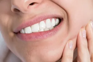 Có nên nhổ răng khôn?