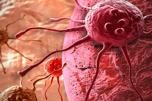 Thiết bị lai sinh học có thể giúp chẩn đoán sớm ung thư và bệnh lao. Ảnh: SPUTNIKNEWS. COM 