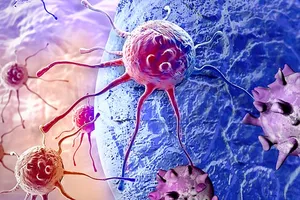 Hơn 300.000 người đang sống chung  với ung thư