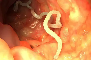 Hơn 100 người nhiễm ấu trùng sán dây lợn 