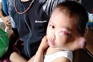 Hộ nghèo dân tộc Jrai có 3 con bệnh nặng