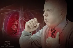 Chẩn đoán Covid-19 qua tiếng ho