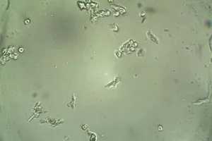 Đã điều chế thành công vaccine tái tổ hợp có khả năng tăng cường hệ miễn dịch đối với đơn bào Entomoeba histolytica, tác nhân gây bệnh do amip 