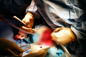 Bác sĩ thực hiện ca phẫu thuật "không truyền máu" cho người bệnh