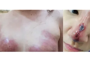 Làm đẹp đón tết: Coi chừng rước họa