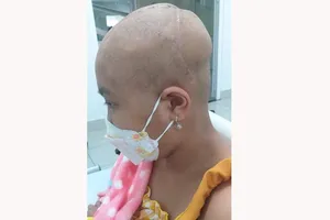 Bé Như Ý đang điều trị  tại Bệnh viện  Trung ương Huế