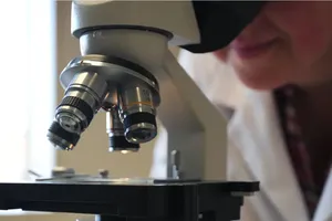 Các nhà khoa học phát triển kỹ thuật mới giúp chẩn đoán bệnh Parkinson