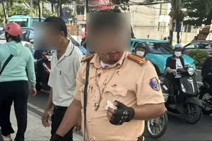 Cán bộ CSGT bị tấn công chảy máu khi đang làm nhiệm vụ. Ảnh: P.A